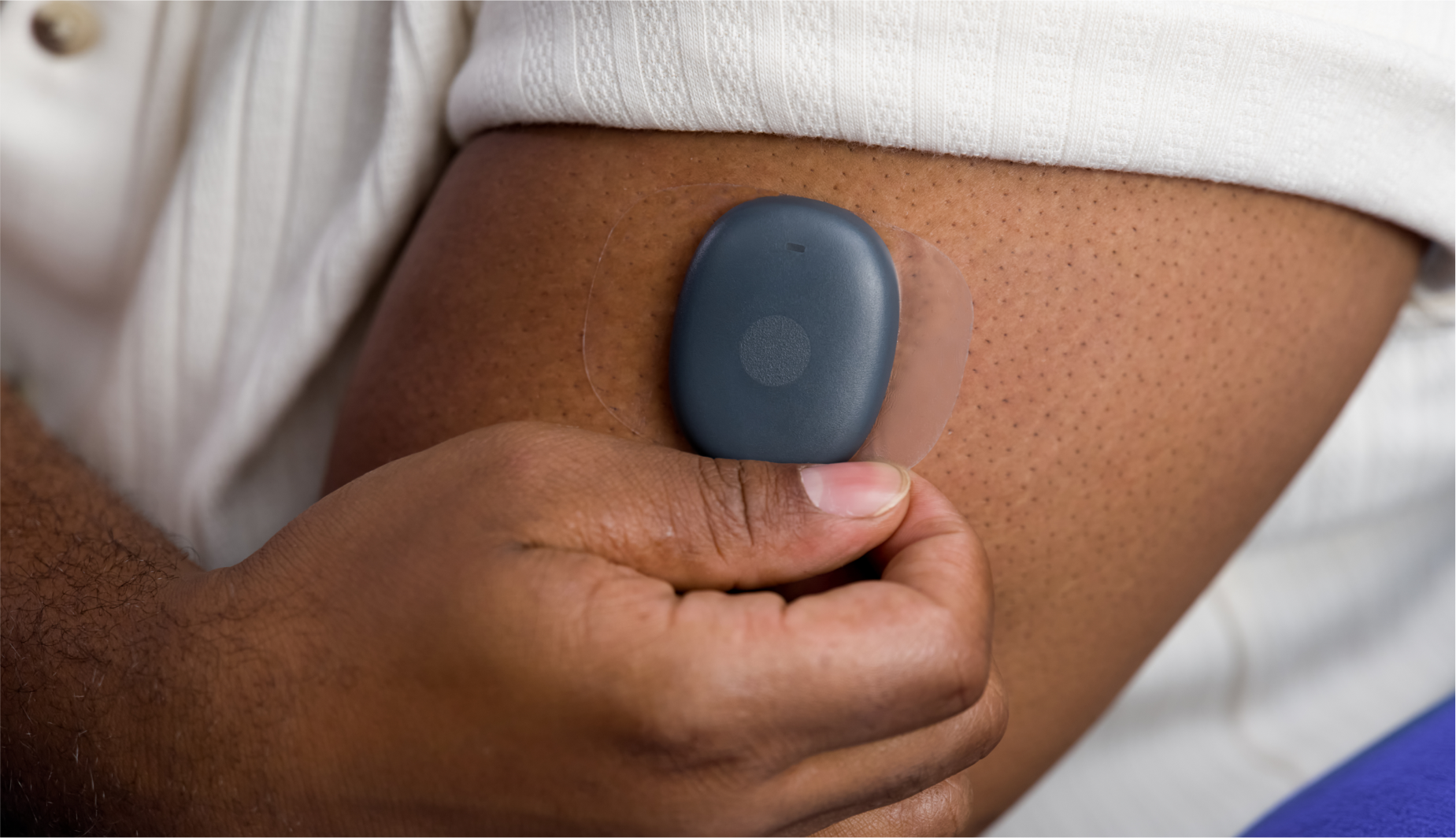 Eversense user applies CGM device to their upper arm, in a close-up view.